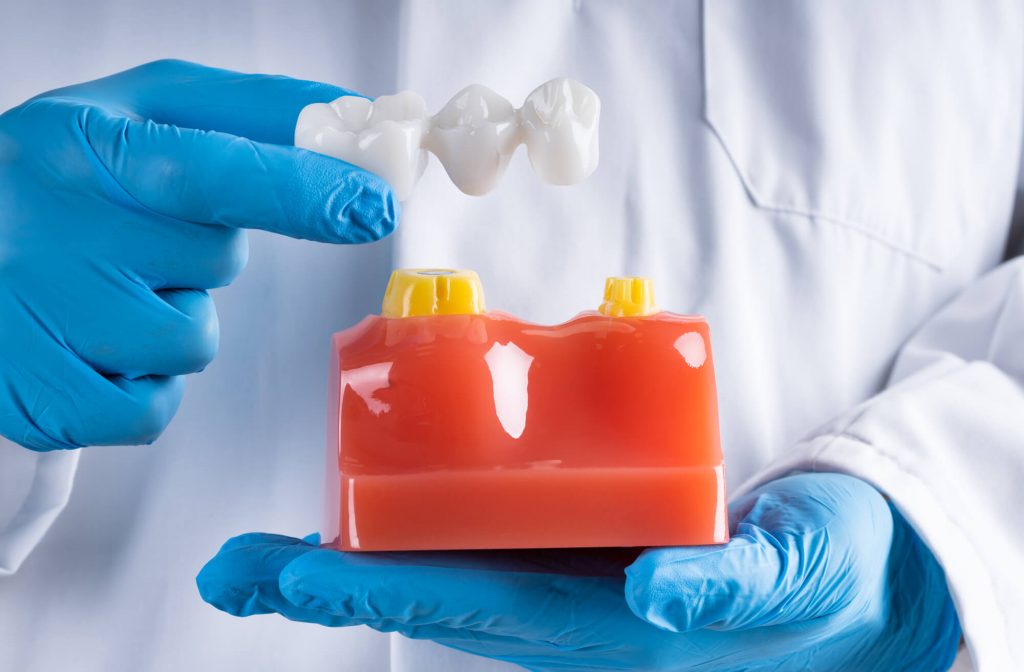 who offers the best crowns simpsonville sc?