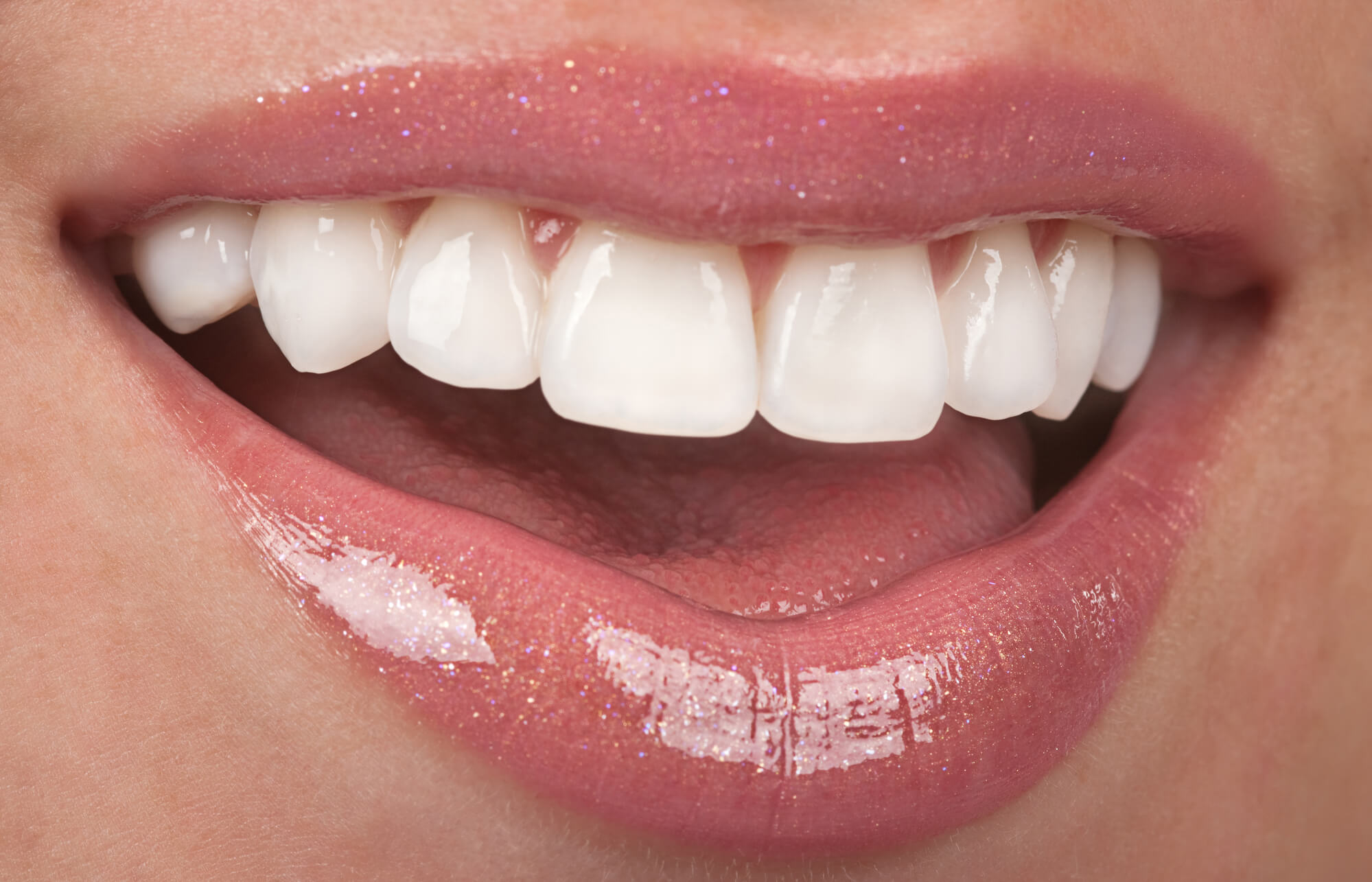 where is the best teeth whitening greenville sc?
