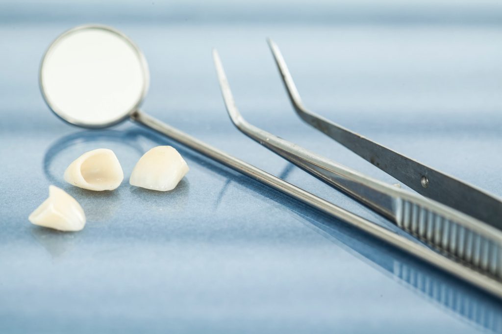 veneers-dentist-greenville-sc