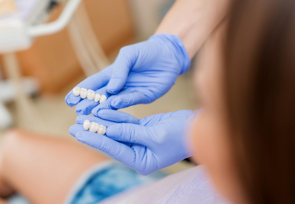 cosmetic-dentist-greenville-sc-veneers