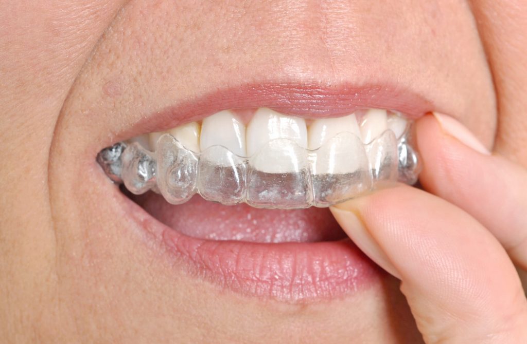 Where can I get Invisalign Greenville SC?