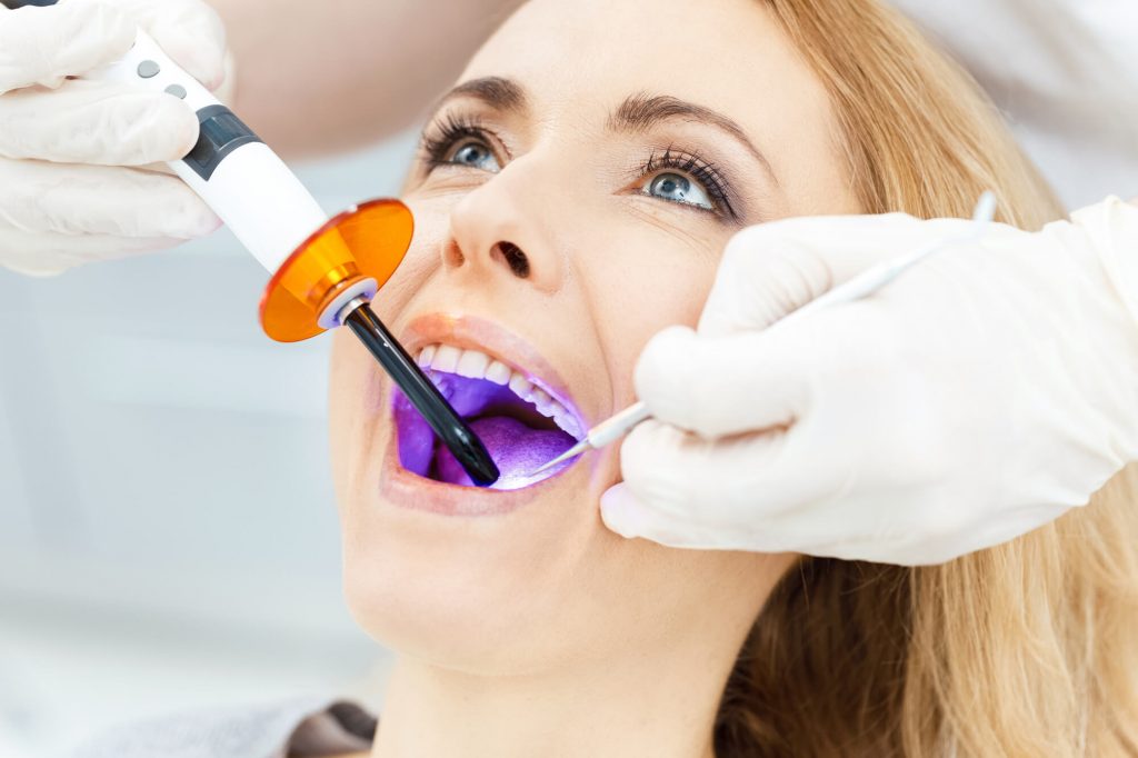 Where can I find teeth whitening Greenville SC?