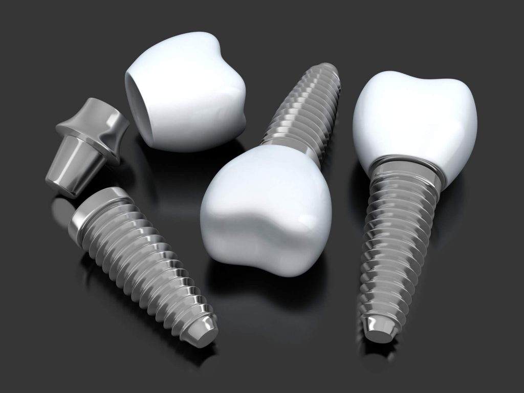 Where can I get dental implants Simpsonville SC? 