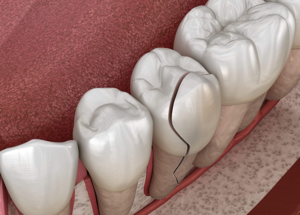 Who is the best emergency dentist Simpsonville SC?