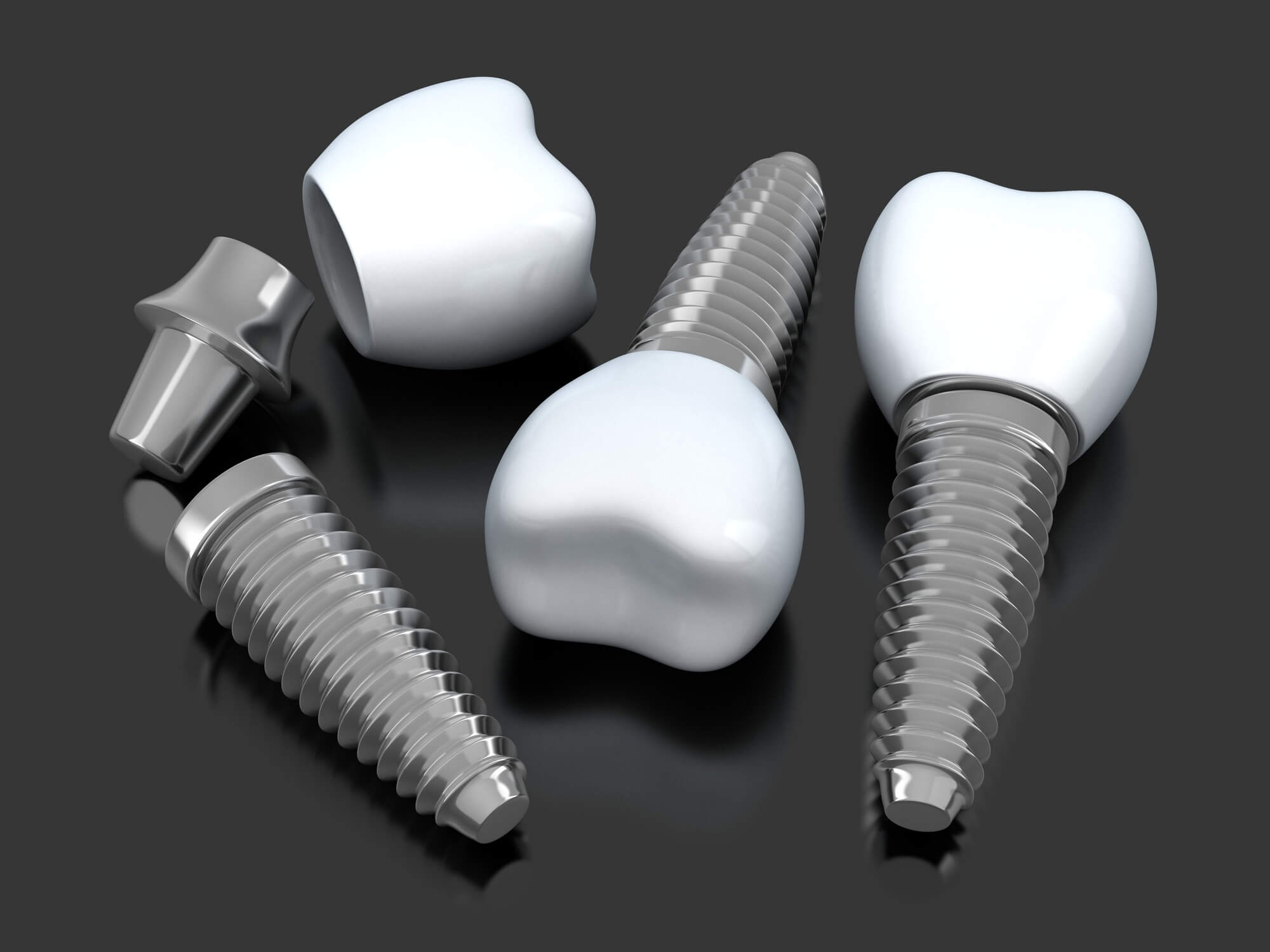 dental implants Greenville SC