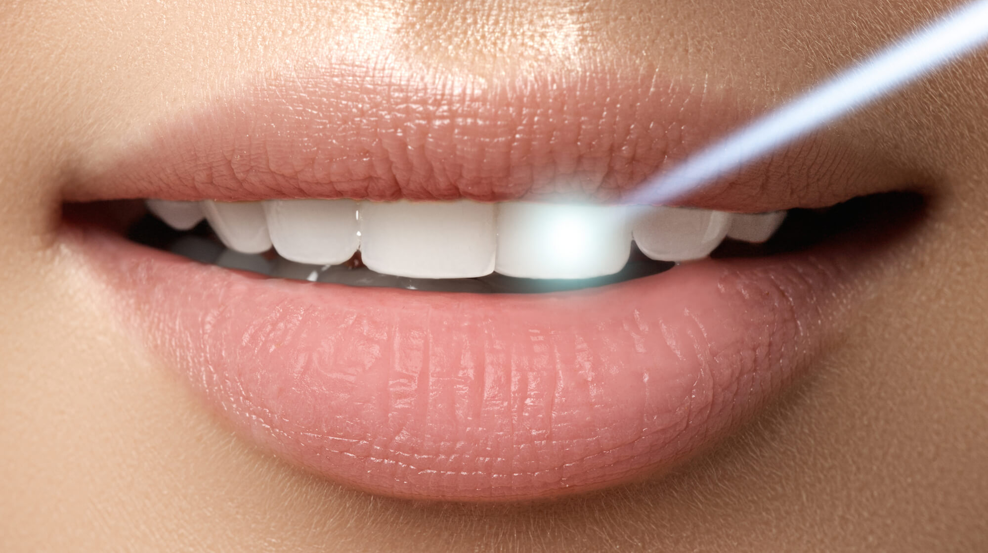 teeth shines because of teeth whitening in Simpsonville, SC