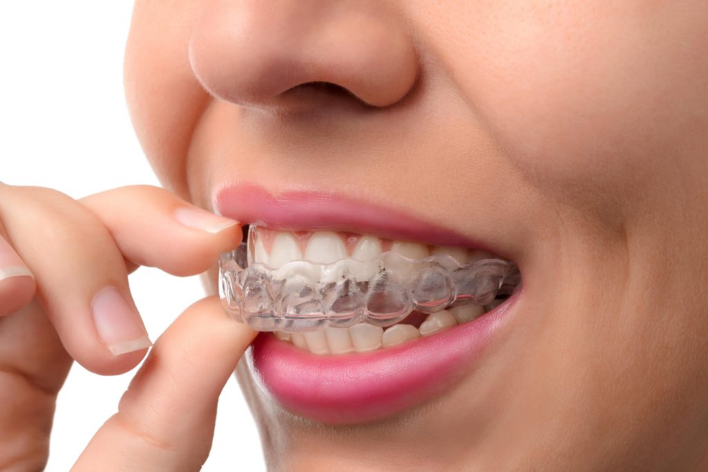 Woman with her Invisalign Simpsonville SC  