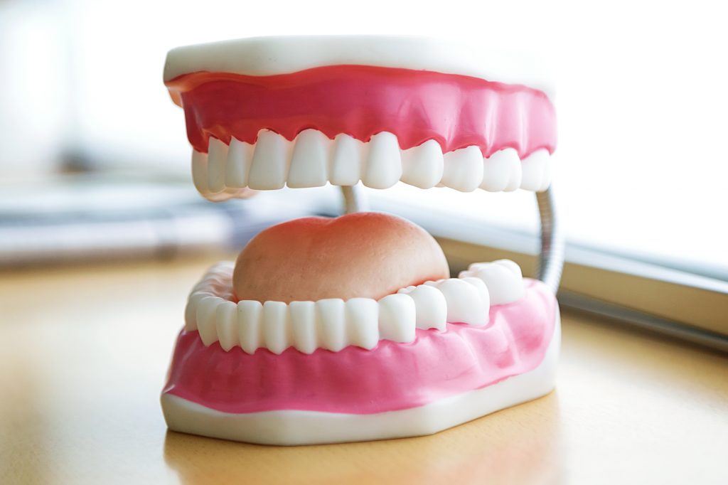 sample of dentures in Greenville SC 