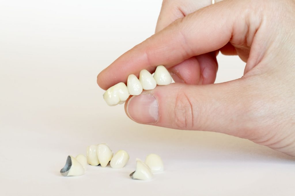 dentist holding crowns in Simpsonville SC 