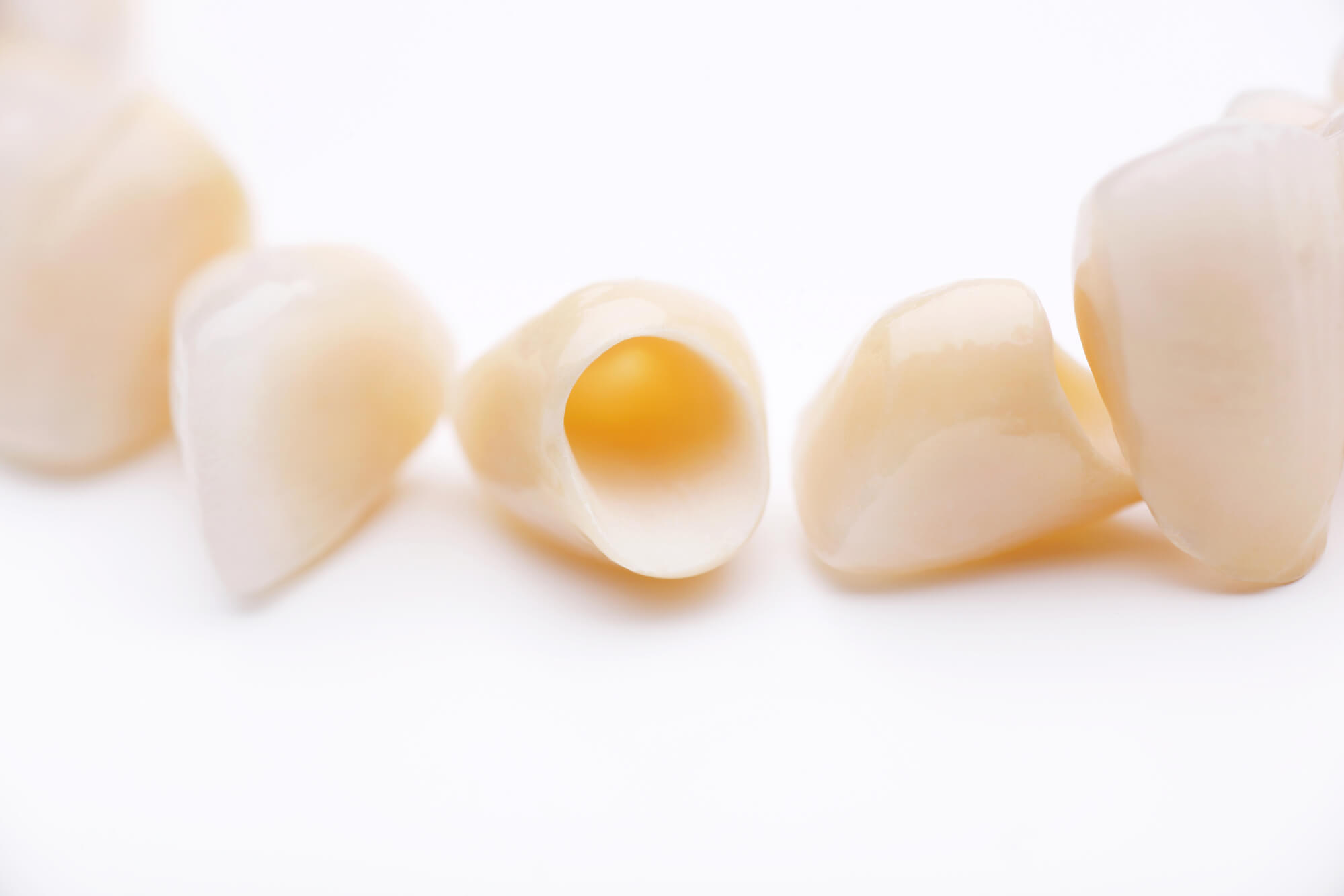porcelain crowns in Simpsonville SC 