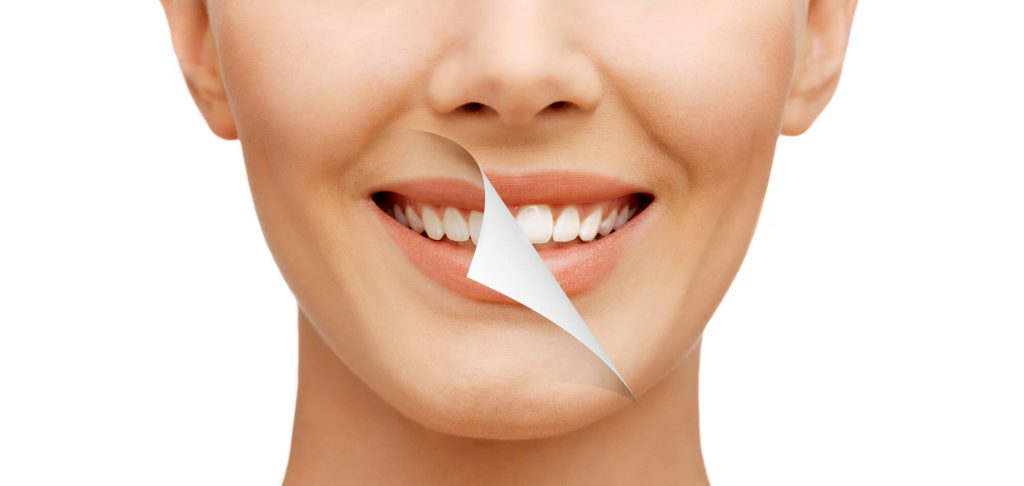 woman showing before and after smile after seeing a cosmetic dentist in Greenville SC