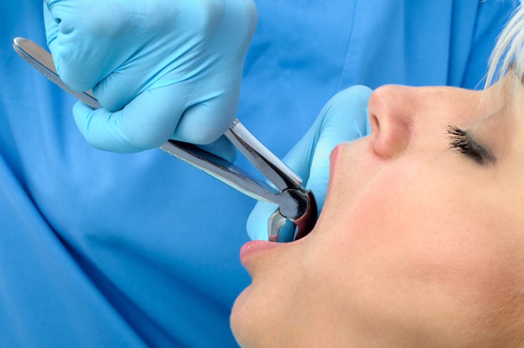 dentist during tooth extraction in Greenville SC