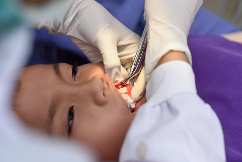 boy getting tooth extractions Simpsonville SC for his orthodontic treatment