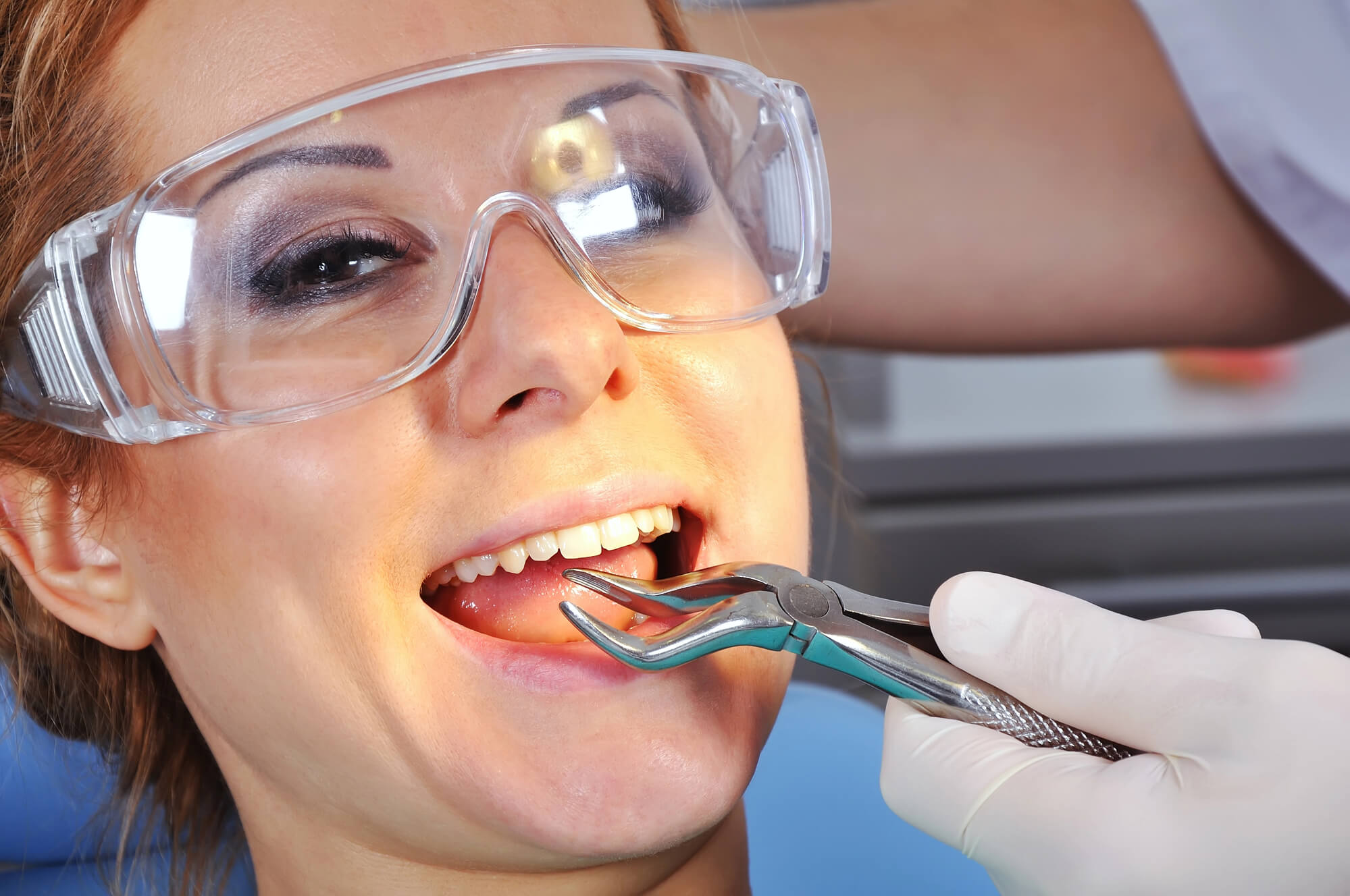 woman about to undergo tooth extractions Simpsonville SC